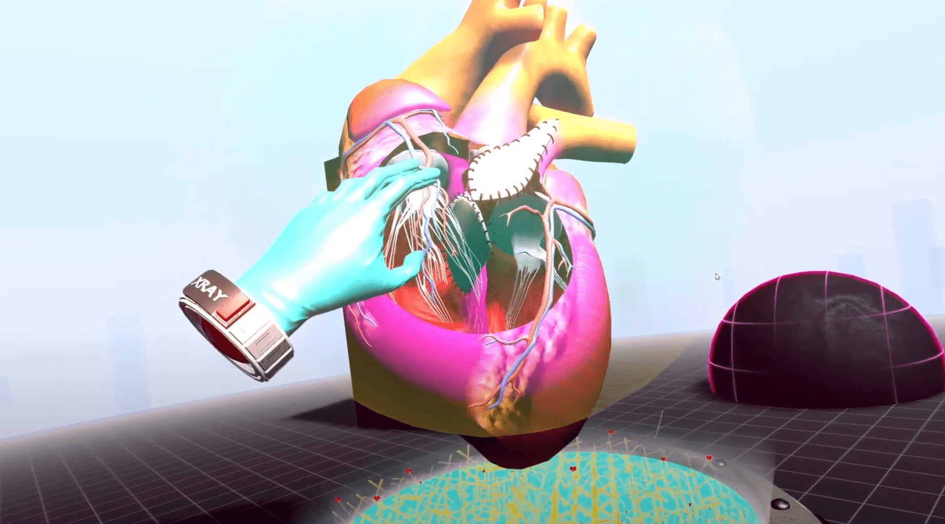 VR planning heart surgery